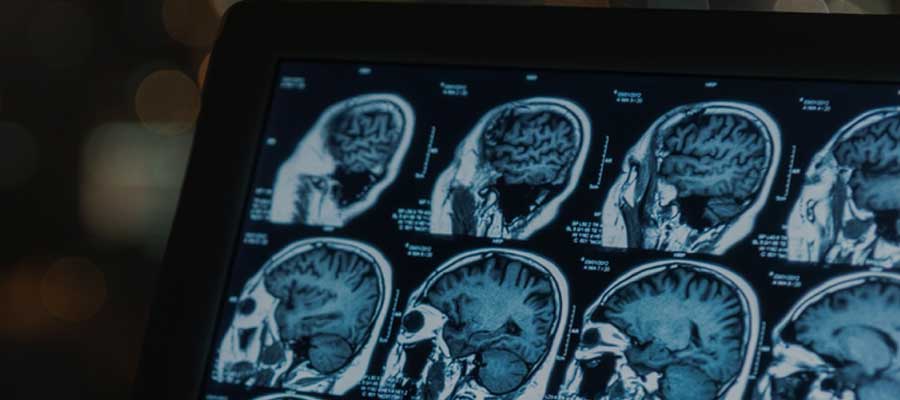 Radiology Technologist and Technician Schools, Programs ...