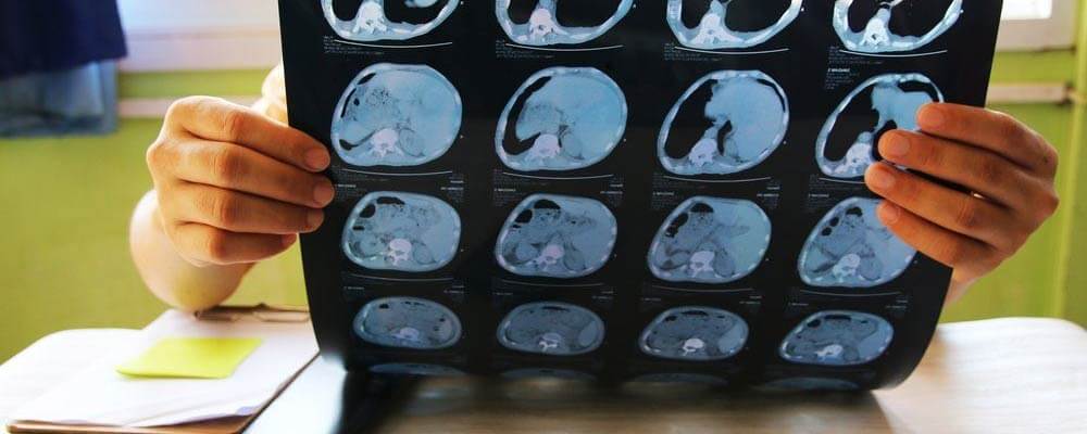 MRI Technologist Salary in Florida