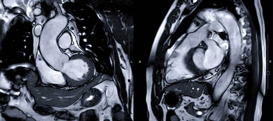 Online Certificate in Magnetic Resonance Imaging